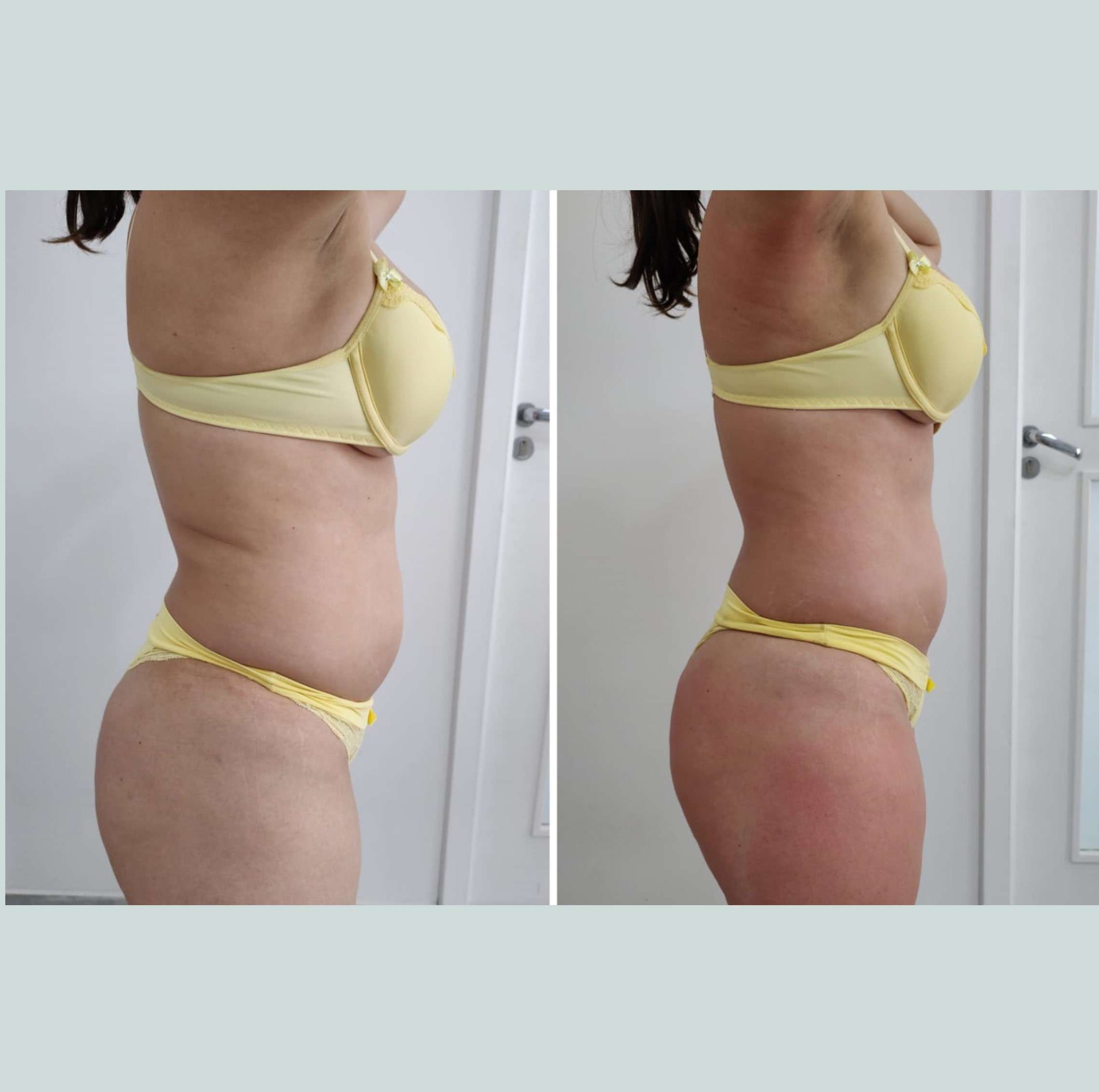 antes-depois-salao-beamme-piracicaba