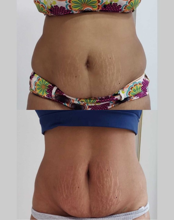 estetica-corporal-studio-beamme-by-mascarin