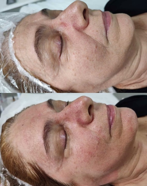 facial-studio-beamme-vila-rezende-piracicaba
