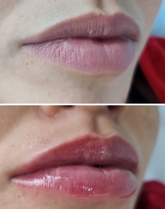 hidratacao-labial-studio-beamme-mascarin-piracicaba